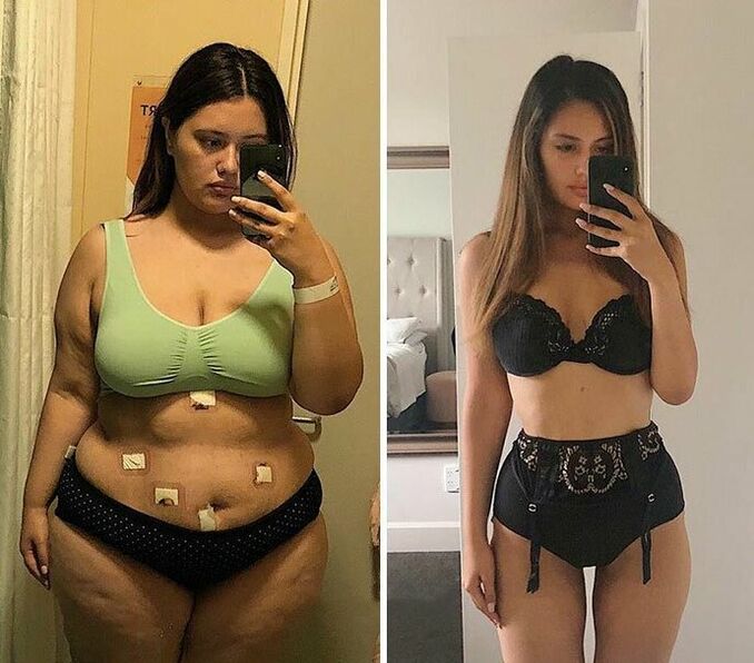 Gadis sebelum dan selepas penurunan berat badan dengan kapsul KETO Complete